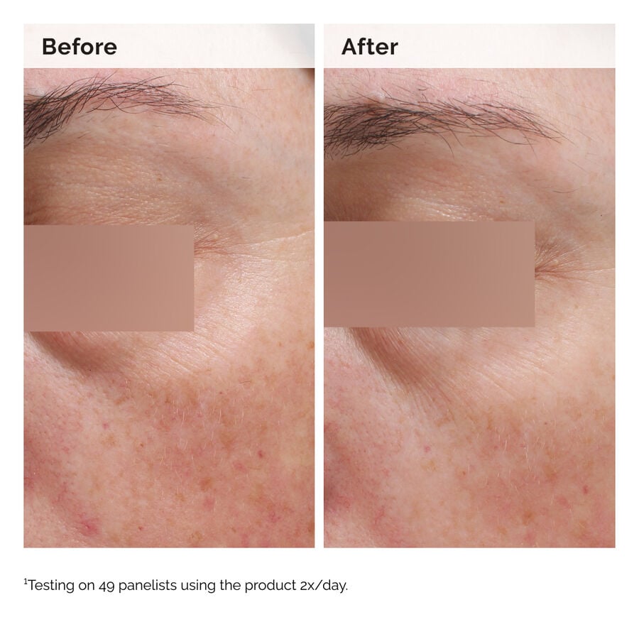 niacinamide-5-face-and-body-emulsion-k4 2024-08-23-ORD-Nia-5pct-Face-Body-B-A-Elasticity-Global-02-1x1.jpg