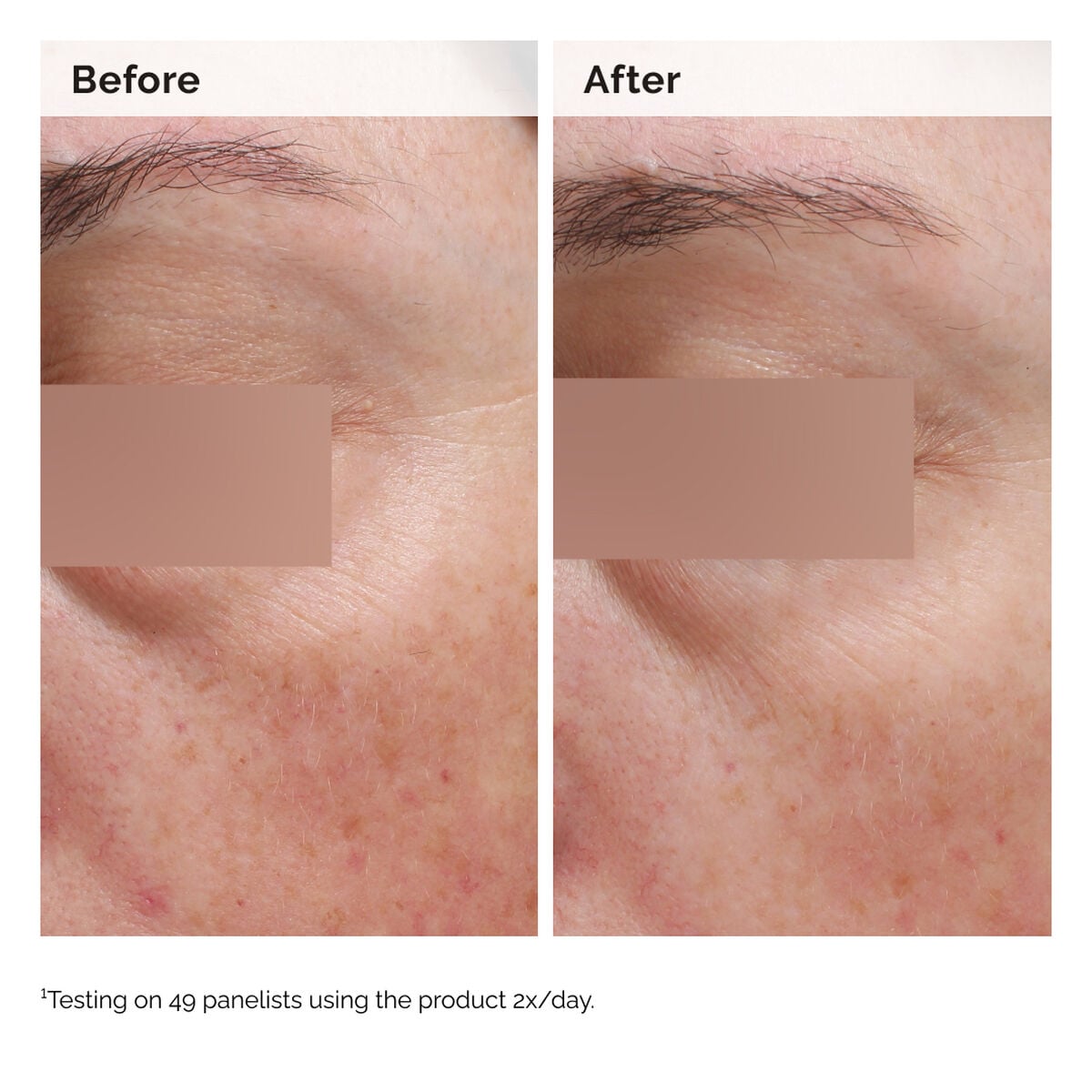 niacinamide-5-face-and-body-emulsion-k4 2024-08-23-ORD-Nia-5pct-Face-Body-B-A-Elasticity-Global-02-1x1.jpg