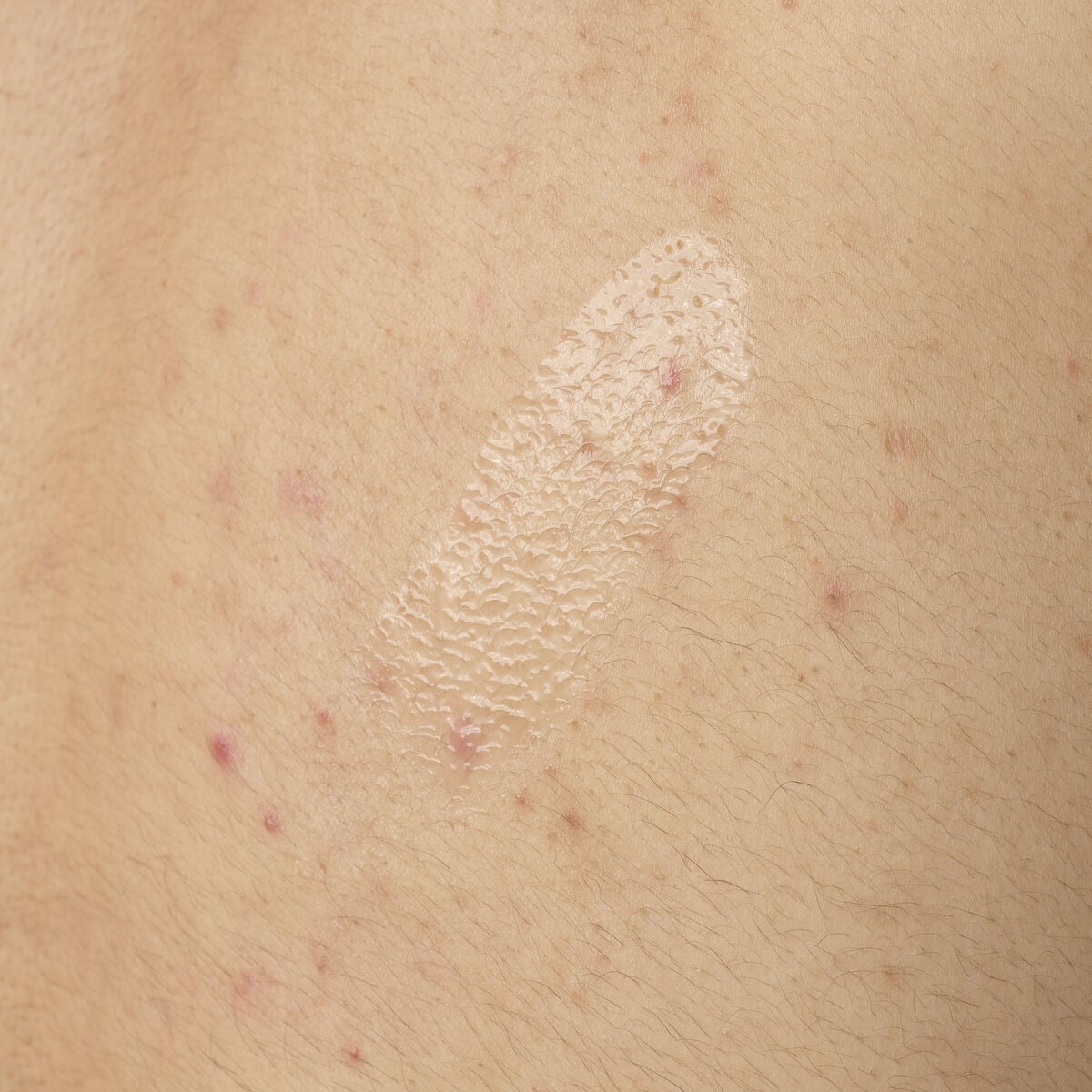 salicylic-acid-0-5-body-serum-y3 ORD-salicylic-acid-05-body-240ml-application.jpg