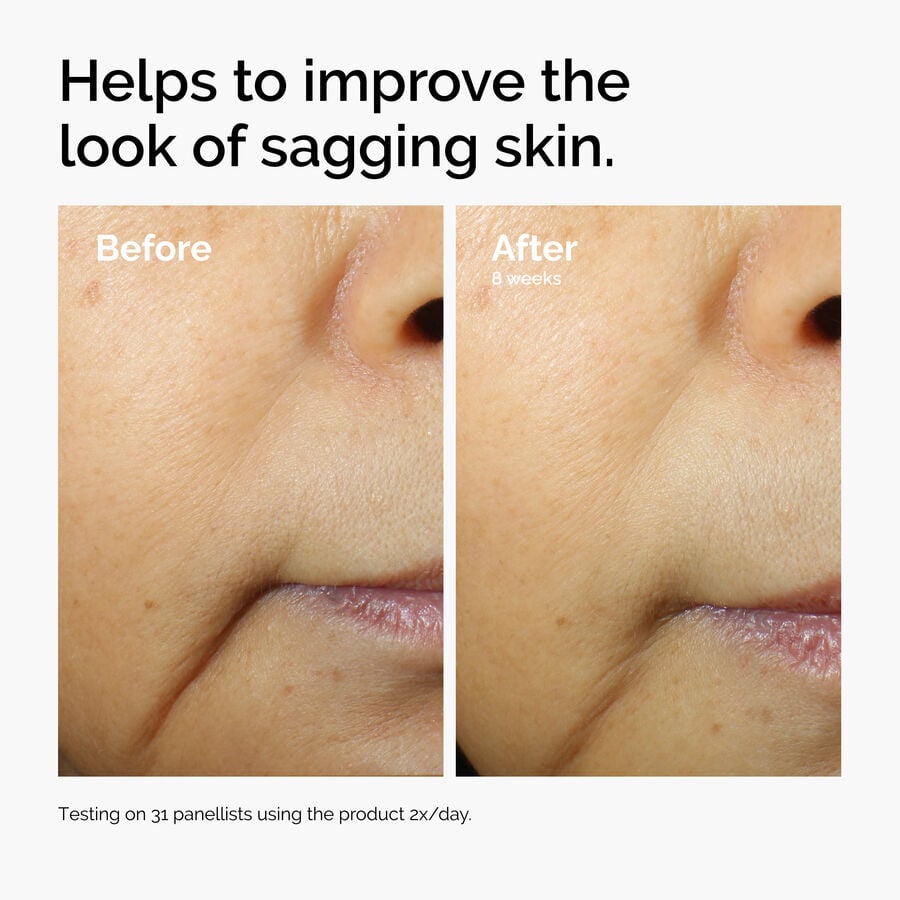 caffeine-3-escin-1-face-serum-x5 ord-caffeine-3pct-escin-1pct-face-serum-before-after-sagging.jpg