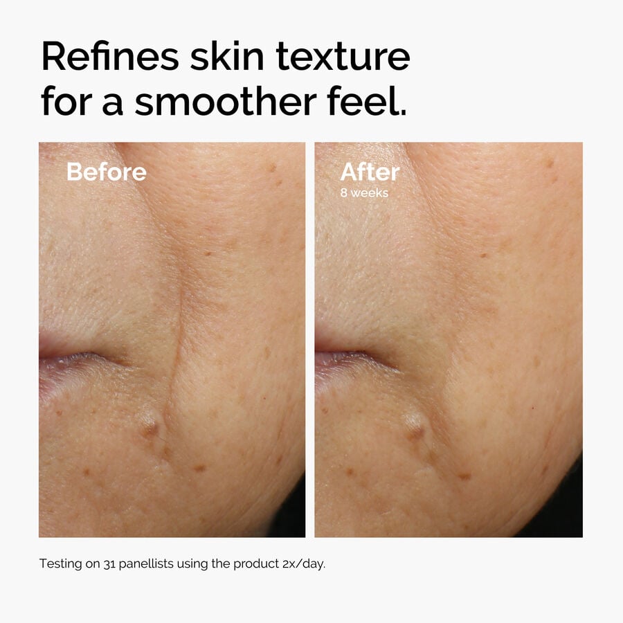 caffeine-3-escin-1-face-serum-x5 ord-caffeine-3pct-escin-1pct-face-serum-before-after-texture.jpg