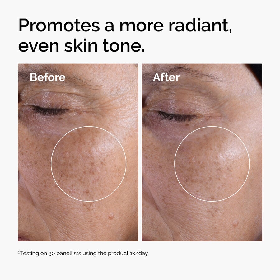 glycolic-acid-7-exfoliating-toner-i5 ord-glycolic-before-after-radiance.jpg
