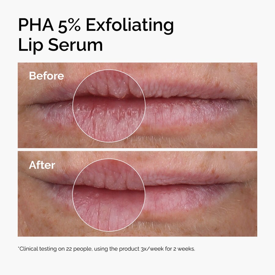 pha-5-exfoliating-lip-serum-w8 ord-pha-5pct-lip-exfoliating-serum-before-after.jpg