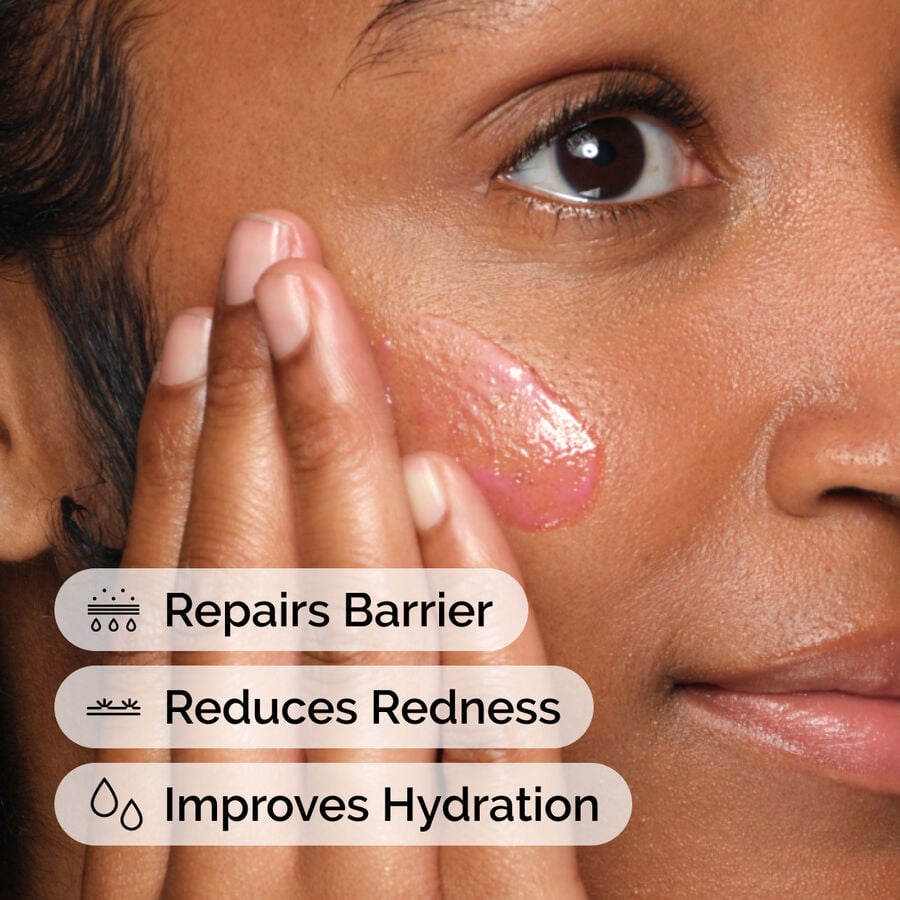 soothing-and-barrier-support-serum-set-f2 ord-soothing-barrier-support-serum-model-application-with-benefits.jpg